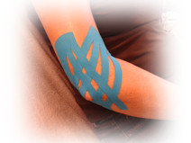 Afbeelding van een elleboog met blauwe lymfetape